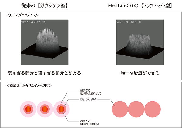 レーザー機器の比較