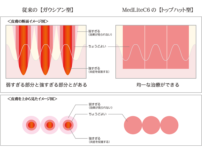 レーザー機器の比較