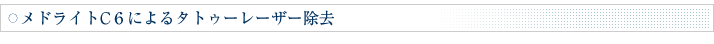 メドライトC6によるタトゥーレーザー除去