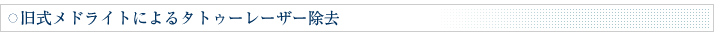 旧式メドライトによるタトゥーレーザー除去